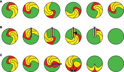 Optogenetic Termination of Cardiac Arrhythmia: Mechanistic Enlightenment and Therapeutic Application?